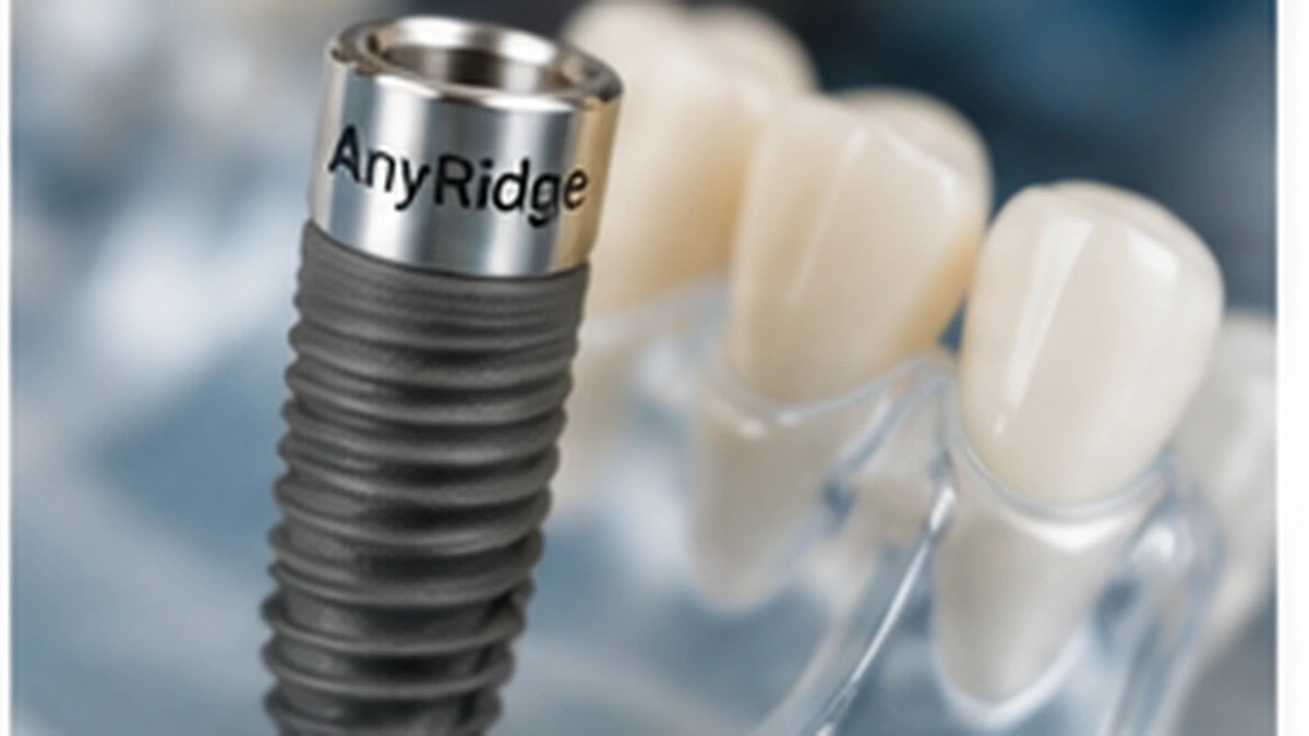 Имплантация AnyRidge в Санкт-Петербурге, планирование установки импланта