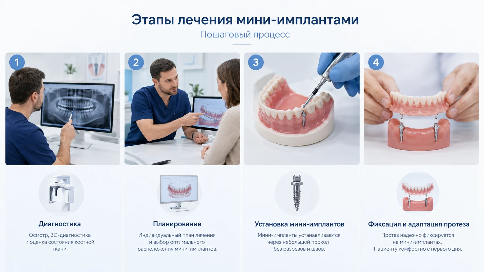 Этапы установки мини-имплантов: диагностика, планирование, установка и фиксация протеза