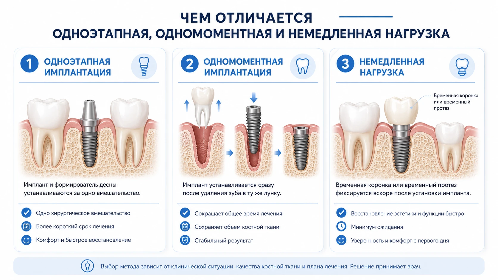 Схема различий между одноэтапной имплантацией, одномоментной установкой и немедленной нагрузкой
