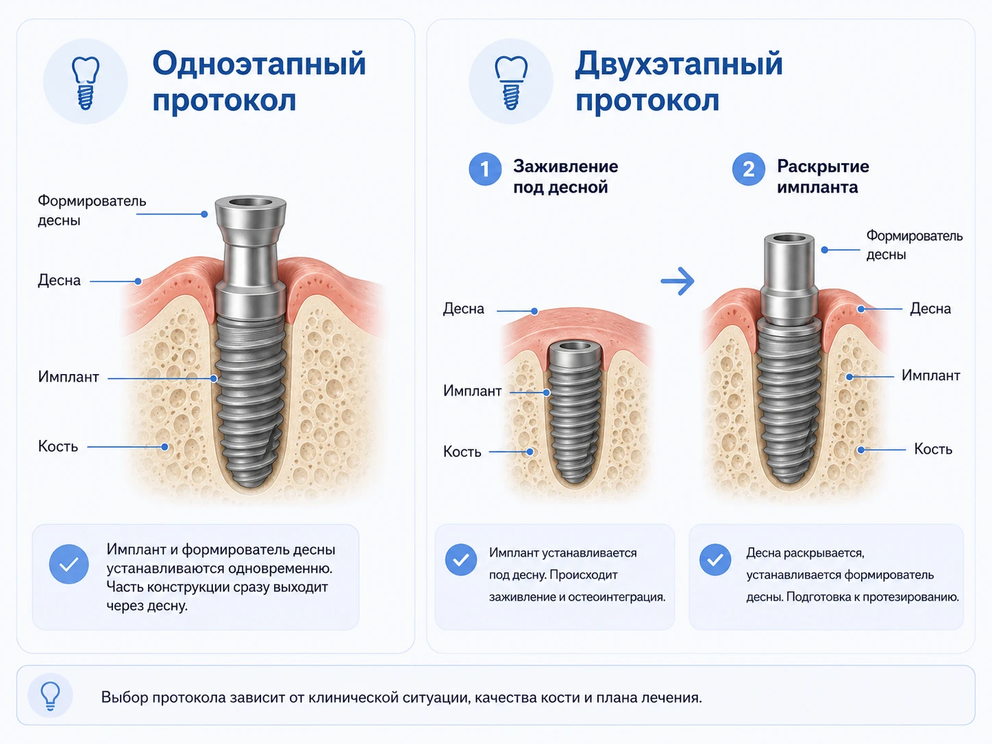 Схема сравнения одноэтапного и двухэтапного протокола имплантации