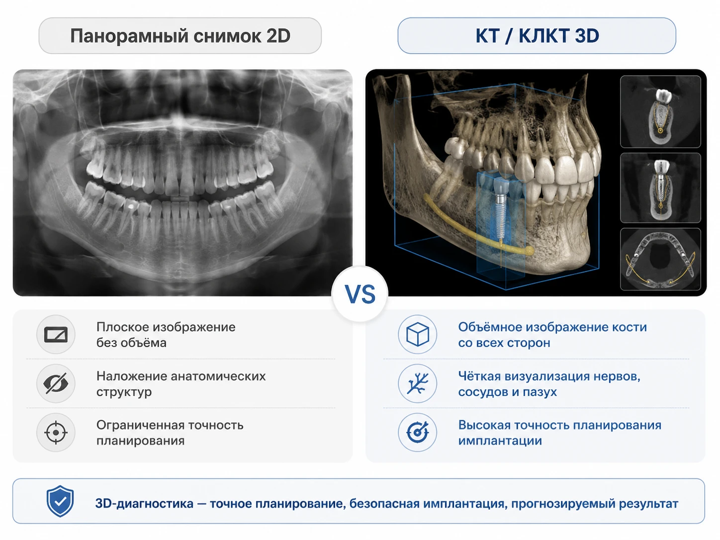 Сравнение панорамного снимка и 3D-КТ перед имплантацией зубов