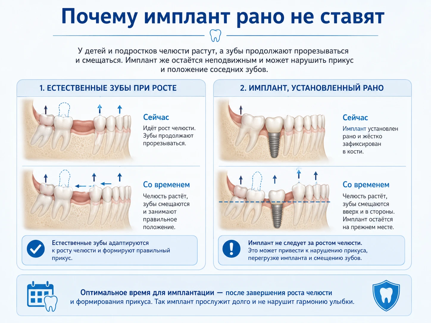 Инфографика: естественные зубы продолжают прорезываться, а имплант остаётся неподвижным