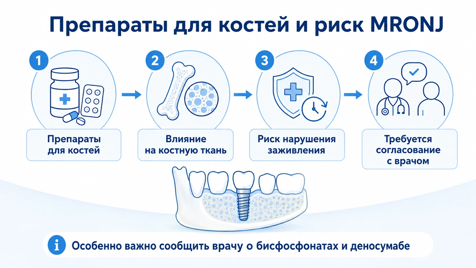 Схема связи препаратов для костной ткани с риском остеонекроза челюсти перед имплантацией