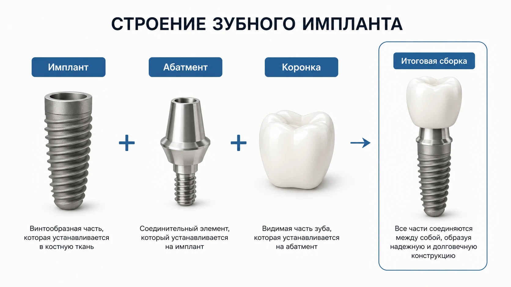 Схема трёх частей восстановления зуба: имплант, абатмент и коронка