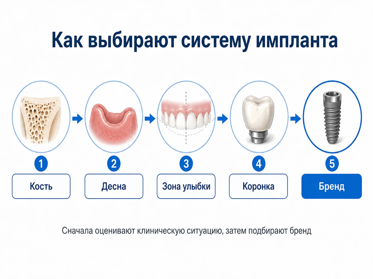 Схема выбора бренда импланта: кость десна зона улыбки коронка бренд
