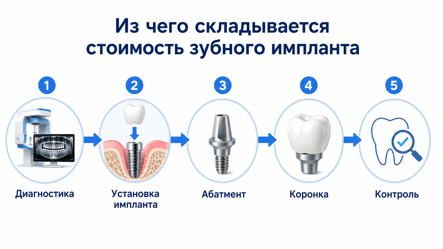 Инфографика из чего складывается стоимость имплантации: диагностика, установка импланта, абатмент, коронка и контроль