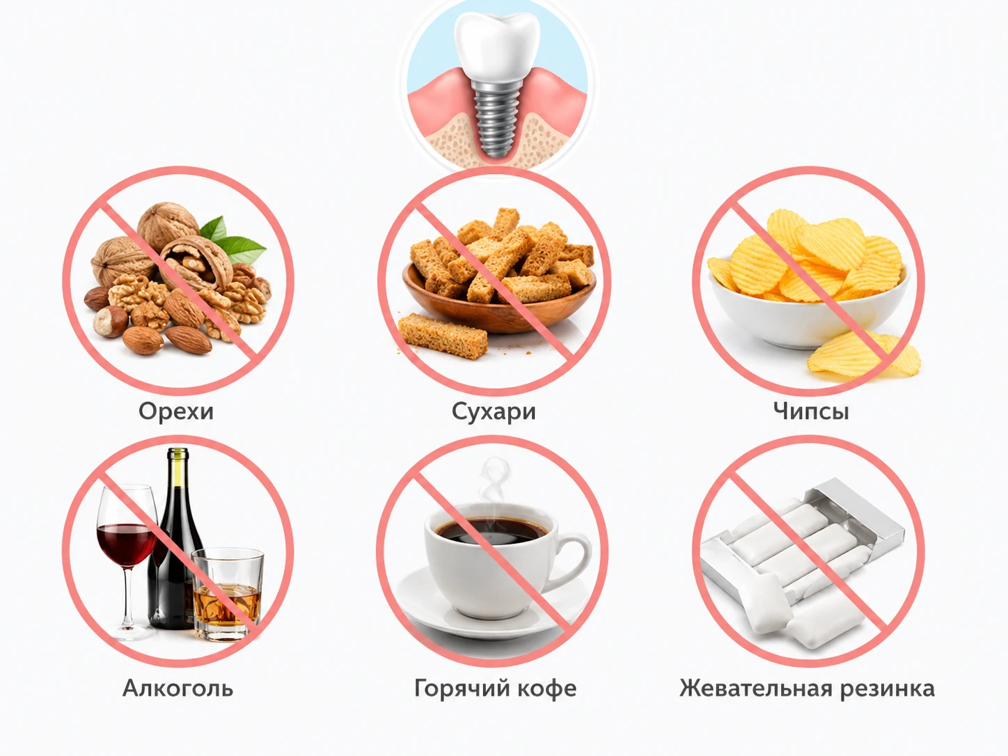 Иллюстрация запрещённых продуктов после имплантации: орехи, сухари, чипсы, алкоголь, горячий кофе и жевательная резинка